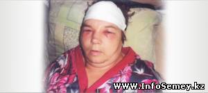 Кирпич с древнего здания выплатного цента, расположенного по улице Уранхаева, 57 искалечил семейчанку