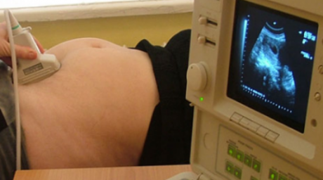 Семейский роддом выплатит крупную сумму женщине за лишение радости материнства